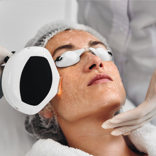 IPL photofacial treatment at BHRC