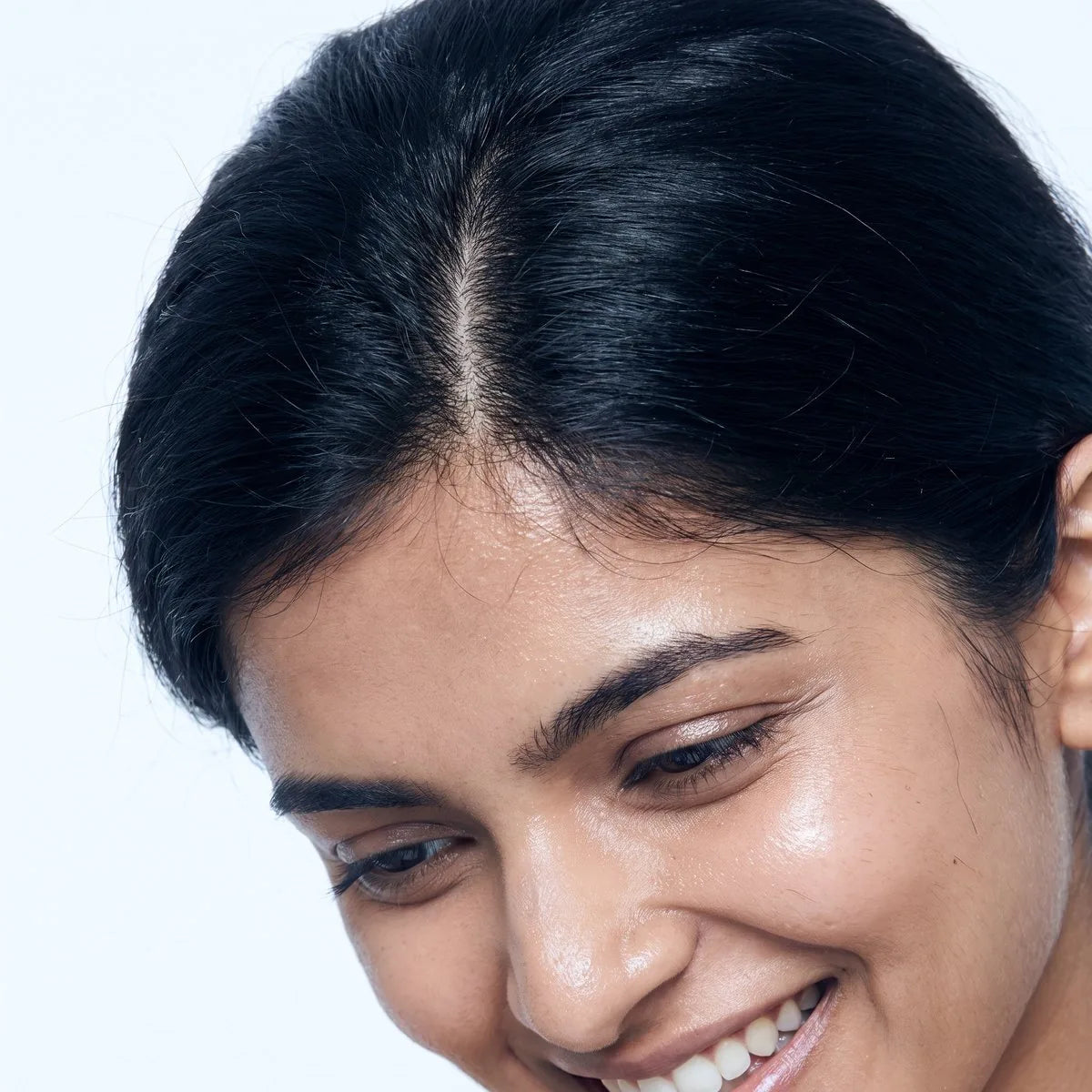 PRP hair restoration at BHRC